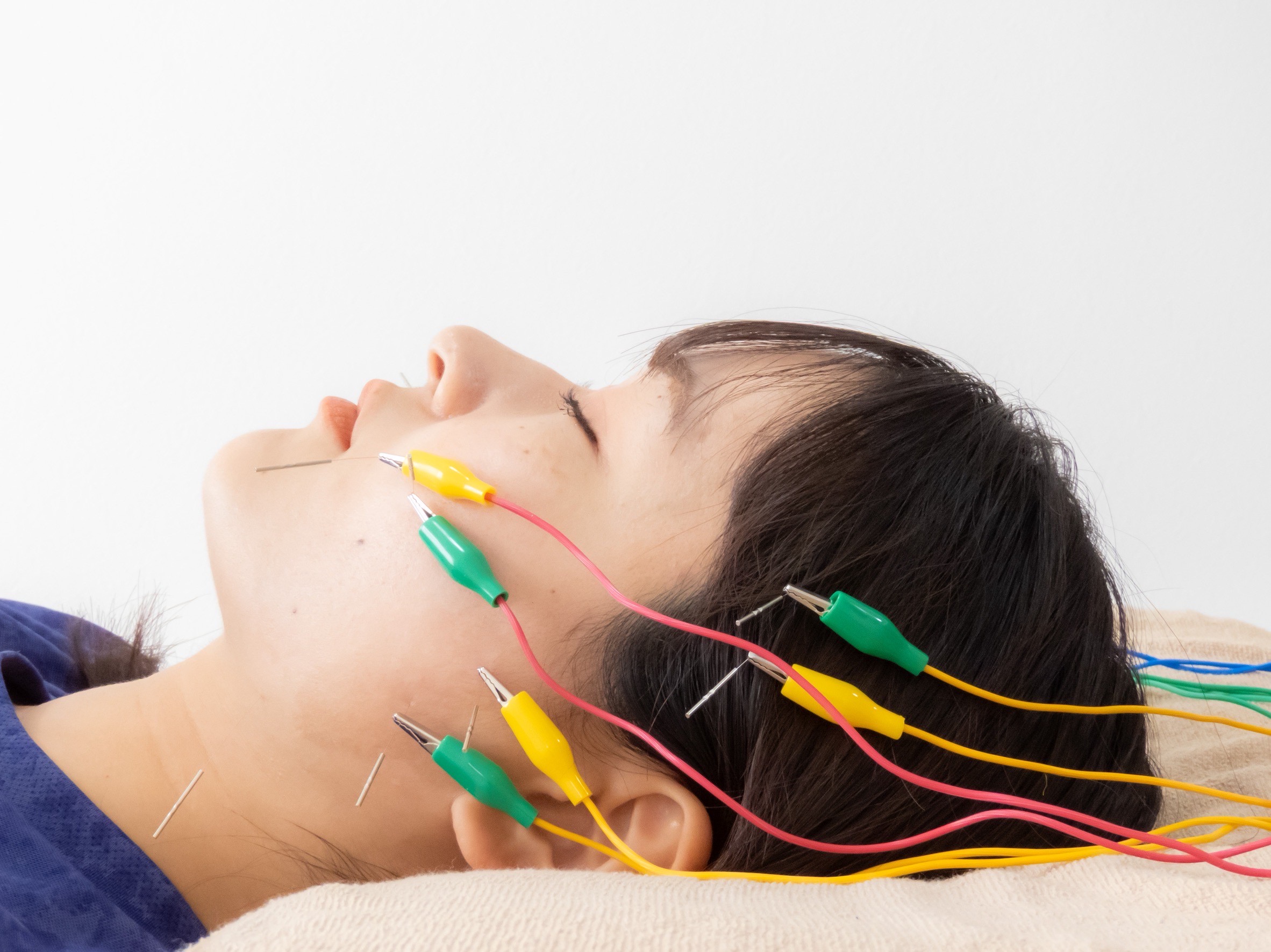 【初めての美容鍼】Moveactでナチュラルにリフトアップ体験！