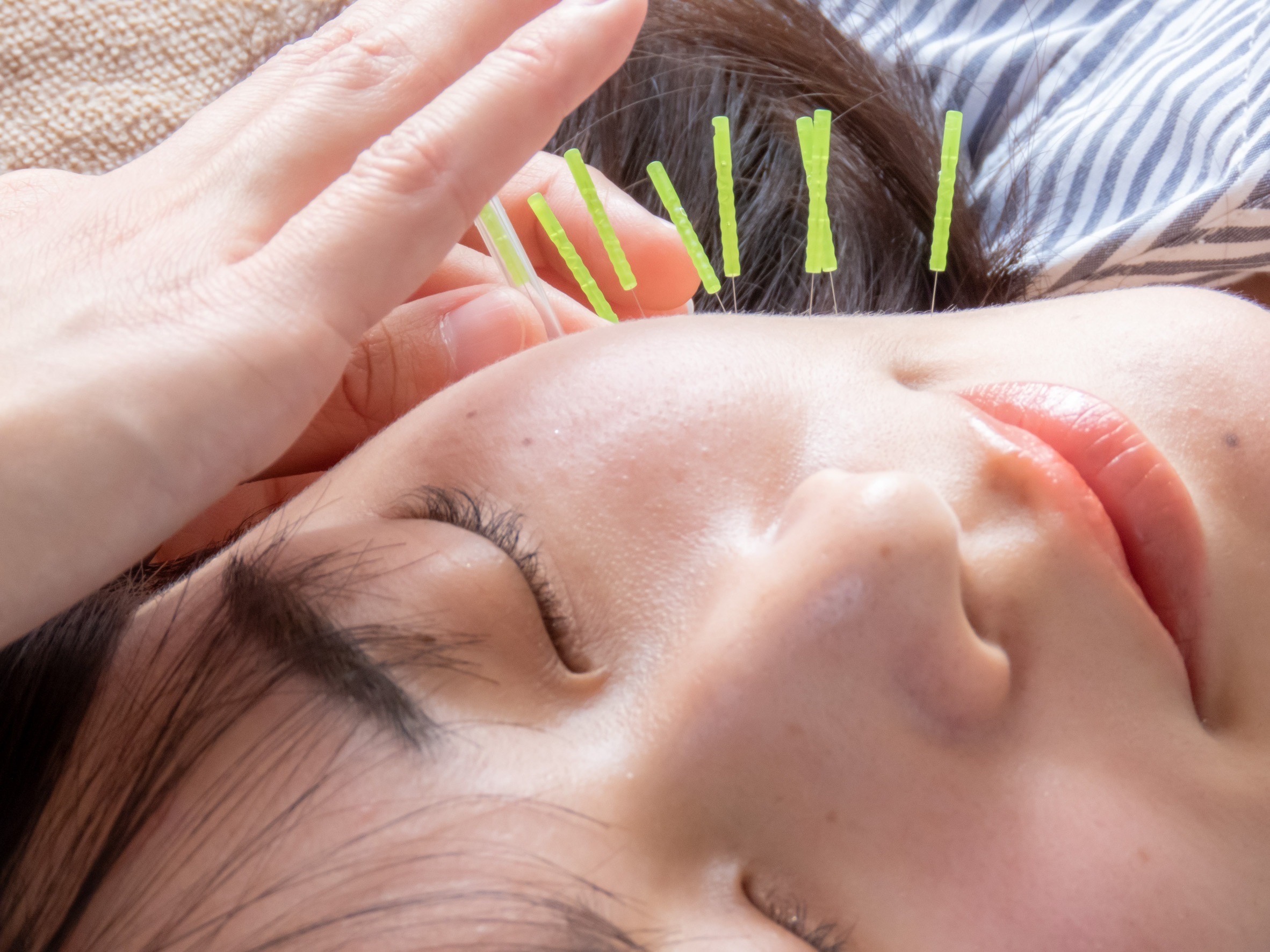 ほうれい線が気になる方への画像1