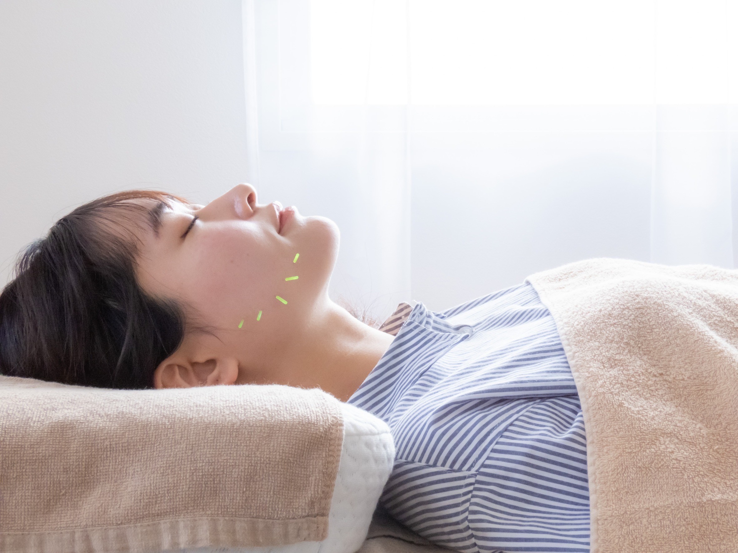 ほうれい線が気になる方へ｜美容鍼でハリ感UP | Moveact