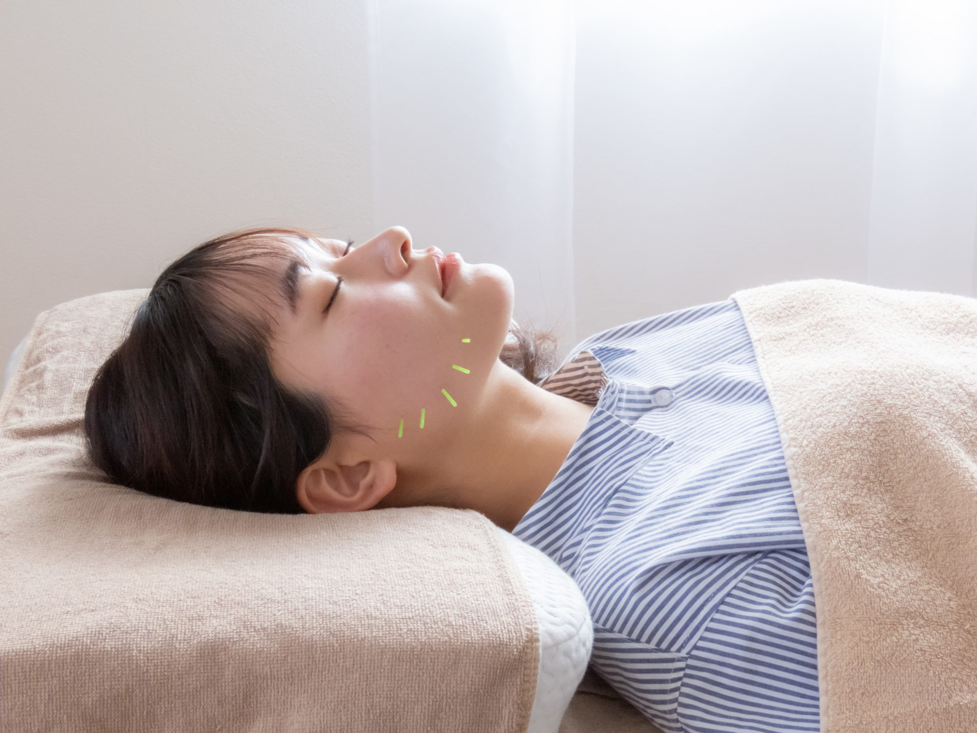 【美容鍼 ニキビ 倉敷】繰り返すニキビ・肌荒れを体質から改善|Moveact玉島店